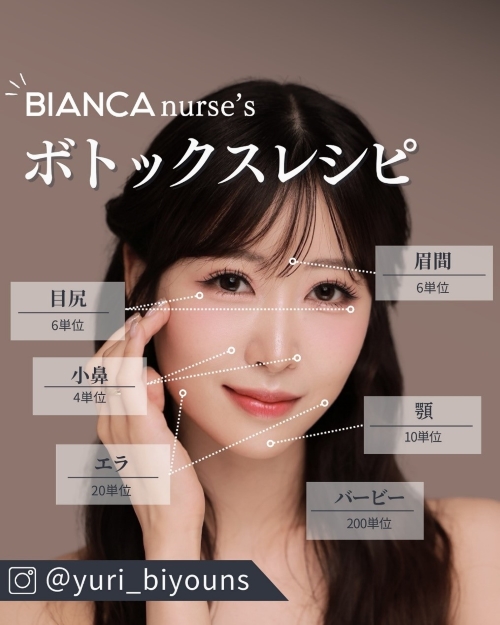 ボトックス施術箇所